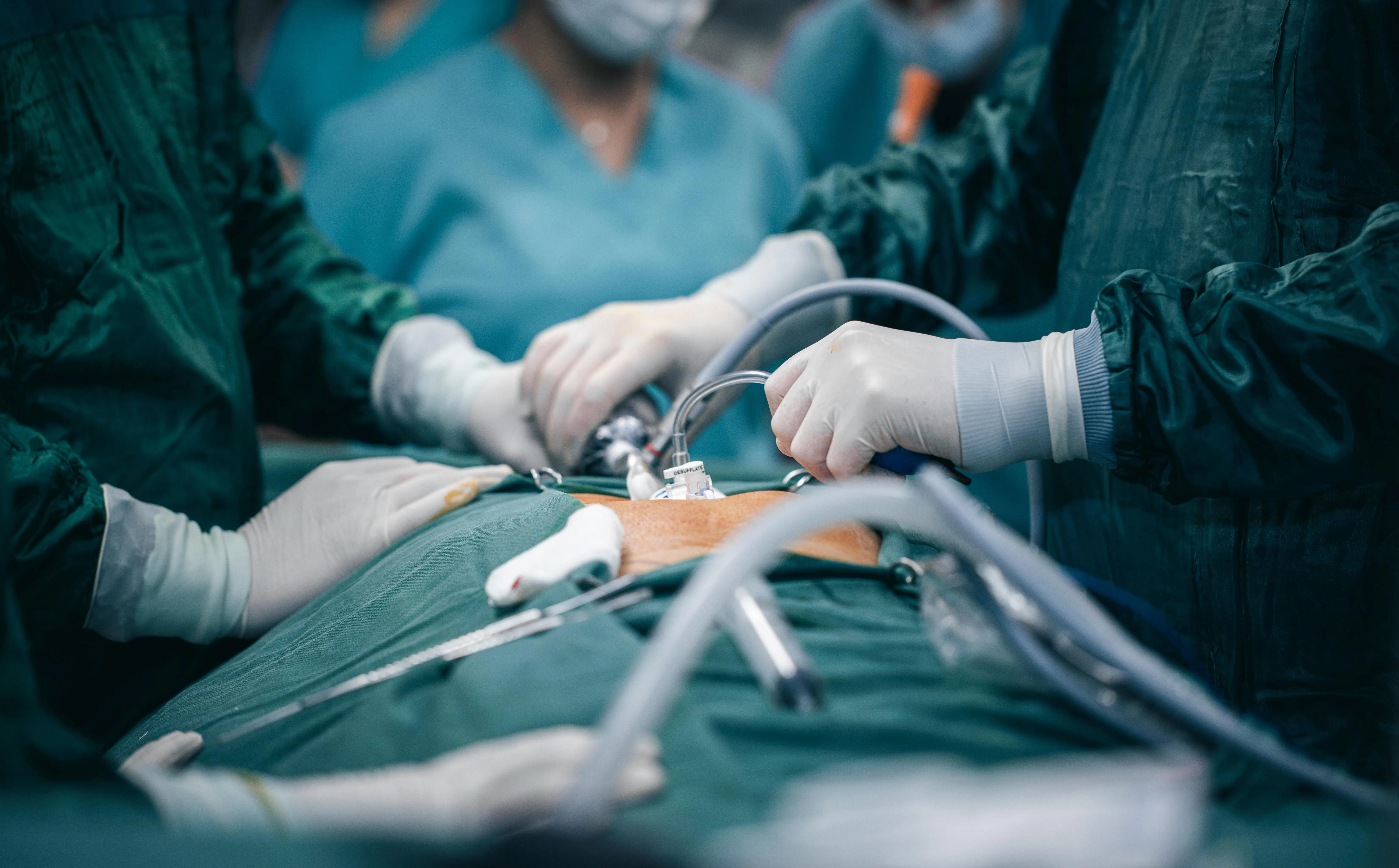 Surgeons' gloved hands using laparoscopic tools during a precise surgical operation.
